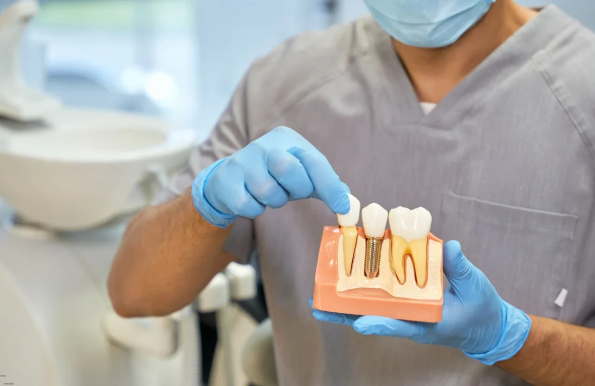 Dental-Implants-kamloops