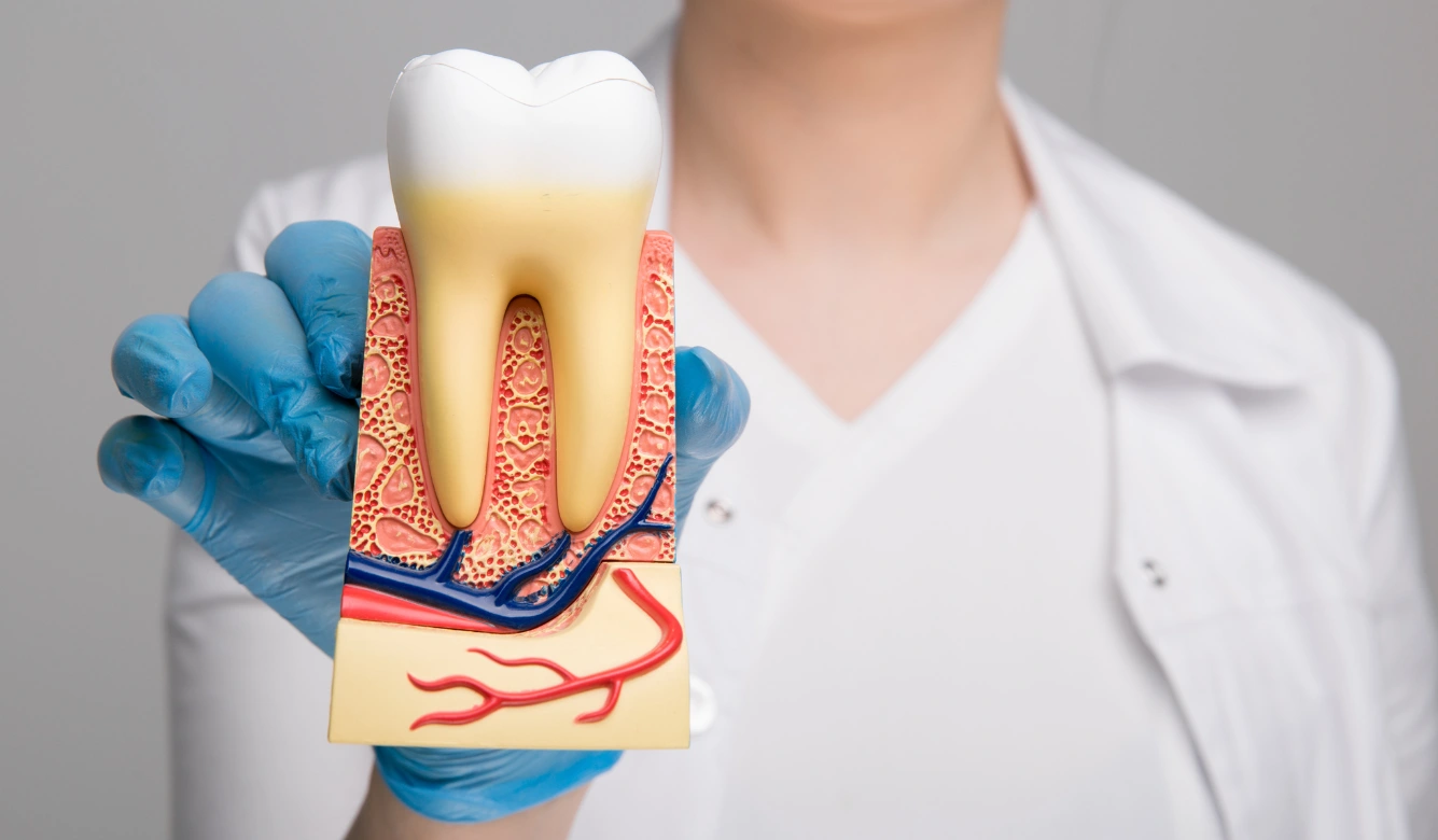 Dental Bridges Kamloops