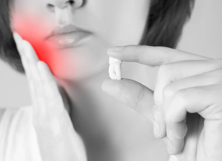 Wisdom-Tooth-Extraction-near-me