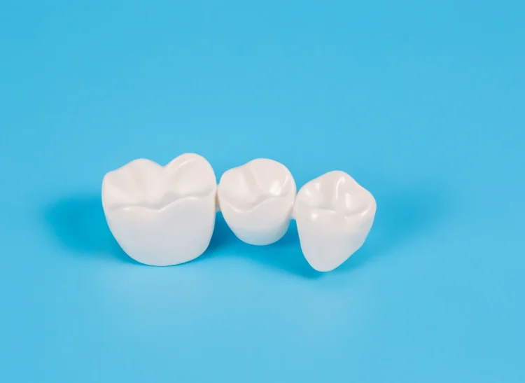 dental-bridges-near-you